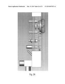 Nitrous Oxide Anesthetic Administration System diagram and image