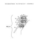 Mason s adjustable chimney-platform arrangement diagram and image