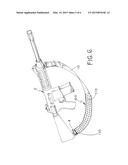 Removable Sling Pad diagram and image