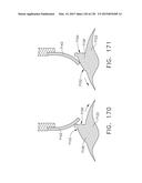 TORQUE OPTIMIZATION FOR SURGICAL INSTRUMENTS diagram and image