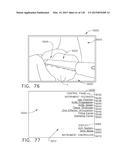 TORQUE OPTIMIZATION FOR SURGICAL INSTRUMENTS diagram and image