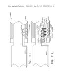 TORQUE OPTIMIZATION FOR SURGICAL INSTRUMENTS diagram and image