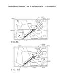 TORQUE OPTIMIZATION FOR SURGICAL INSTRUMENTS diagram and image