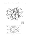 Self-Shielded Split Gradient Coil diagram and image