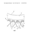 COMPRESSIBLE DECORATIVE STRUCTURE diagram and image