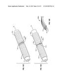 ELONGATED FASTENERS FOR RETAINING INSULATION WRAPS AROUND ELONGATED     CONTAINERS, SUCH AS PIPES, SUBJECT TO TEMPERATURE FLUCTUATIONS, AND     RELATED COMPONENTS AND METHODS diagram and image