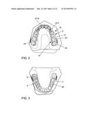 APPARATUS FOR TEMPOROMANDIBULAR JOINT-RELATED CORRECTIONS OF TOOTH     POSITION diagram and image