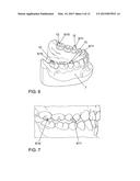 APPARATUS FOR TEMPOROMANDIBULAR JOINT-RELATED CORRECTIONS OF TOOTH     POSITION diagram and image