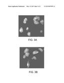 METHODS AND MATERIALS FOR DETECTING GENE AMPLIFICATION diagram and image