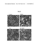 COMPOSITIONS USEFUL FOR TREATING HERPES SIMPLEX KERATITIS, AND METHODS     USING SAME diagram and image