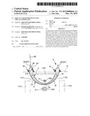 IMPLANT AND METHOD OF PLACING IMPLANT INDWELLING diagram and image