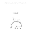 IMPLANT AND METHOD OF PLACING IMPLANT INDWELLING diagram and image