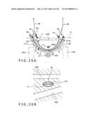 IMPLANT AND METHOD OF PLACING IMPLANT INDWELLING diagram and image