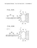 IMPLANT AND METHOD OF PLACING IMPLANT INDWELLING diagram and image