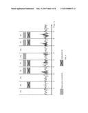 Sleep Spindles as Biomarker for Early Detection of Neurodegenerative     Disorders diagram and image