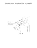 TECHNIQUES FOR DATA RETENTION UPON DETECTION OF AN EVENT IN AN IMPLANTABLE     MEDICAL DEVICE diagram and image