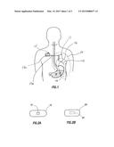 Communication System Using an Implantable Device diagram and image