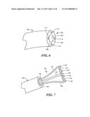 SYSTEM FOR IDENTIFYING THE LOCATION OF A DEVICE WITHIN A PATIENT S BODY IN     ORDER TO LOCATE THE FOSSA OVALIS FOR TRANS-SEPTAL PROCEDURES diagram and image