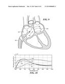 SYSTEM FOR IDENTIFYING THE LOCATION OF A DEVICE WITHIN A PATIENT S BODY IN     ORDER TO LOCATE THE FOSSA OVALIS FOR TRANS-SEPTAL PROCEDURES diagram and image