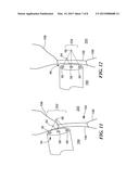 SYSTEM FOR IDENTIFYING THE LOCATION OF A DEVICE WITHIN A PATIENT S BODY IN     ORDER TO LOCATE THE FOSSA OVALIS FOR TRANS-SEPTAL PROCEDURES diagram and image