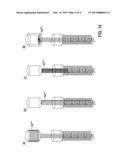 IMPLANTABLE DEVICE diagram and image