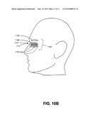 METHODS FOR FACE AND NECK LIFTS diagram and image