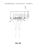 METHODS FOR FACE AND NECK LIFTS diagram and image