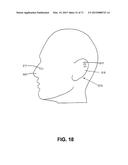 METHODS FOR FACE AND NECK LIFTS diagram and image