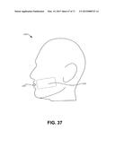 METHODS FOR FACE AND NECK LIFTS diagram and image