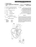 INTRAVASCULAR ROTARY BLOOD PUMP diagram and image