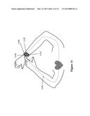 SYSTEMS AND METHODS FOR COORDINATING MUSCULOSKELETAL AND CARDIOVASCULAR OR     CEREBROVASCULAR HEMODYNAMICS diagram and image