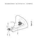 SYSTEMS AND METHODS FOR COORDINATING MUSCULOSKELETAL AND CARDIOVASCULAR OR     CEREBROVASCULAR HEMODYNAMICS diagram and image