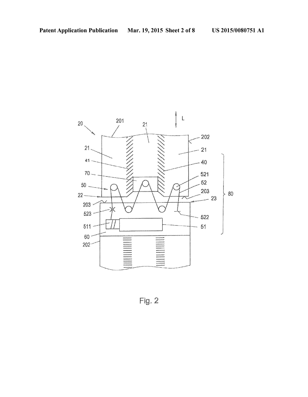 BLOOD PRESSURE MEASURING DEVICE, FLEXIBLE COLLAR FOR A BLOOD PRESSURE     MEASURING DEVICE, AND METHOD FOR BLOOD PRESSURE MEASUREMENT - diagram, schematic, and image 03