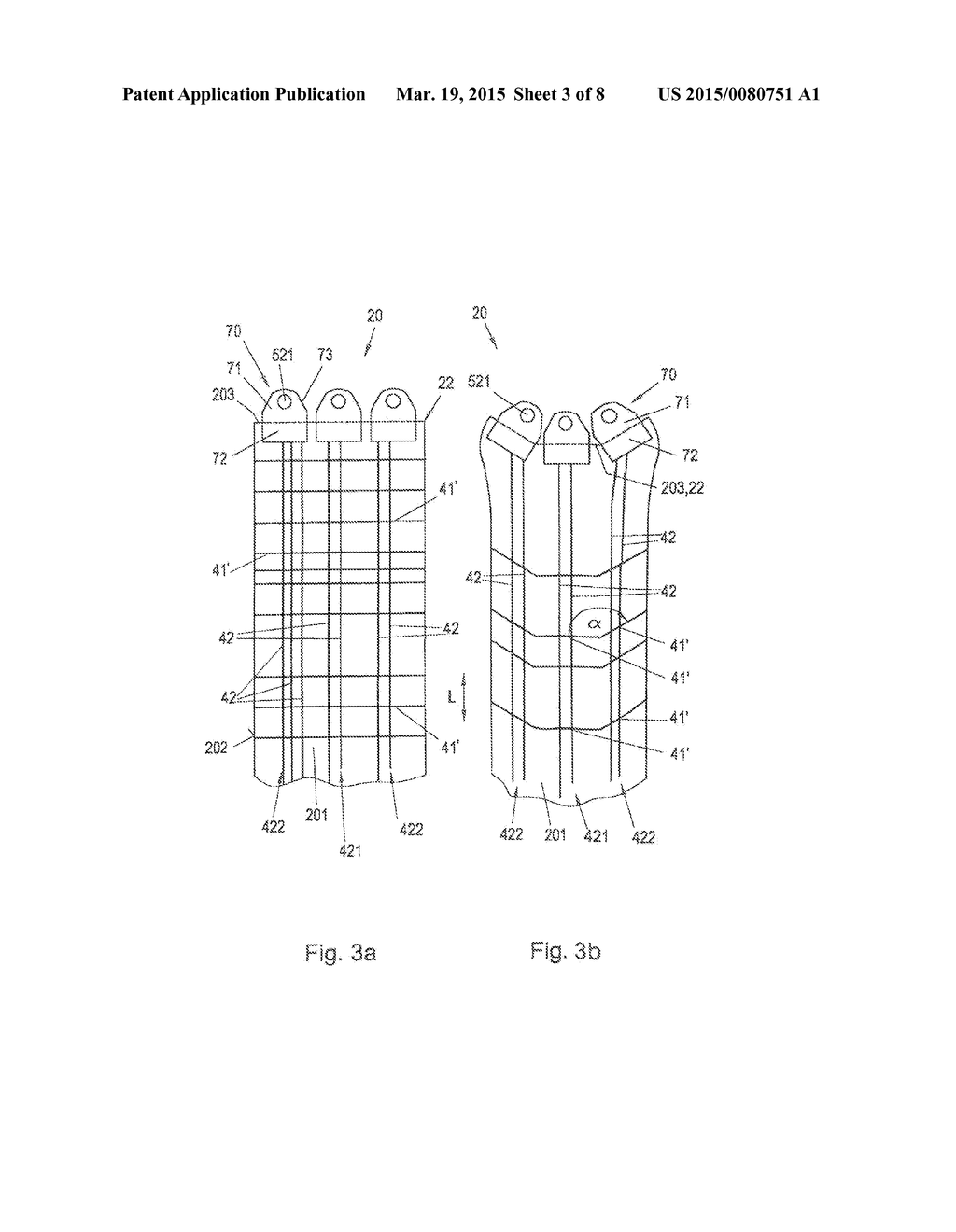 BLOOD PRESSURE MEASURING DEVICE, FLEXIBLE COLLAR FOR A BLOOD PRESSURE     MEASURING DEVICE, AND METHOD FOR BLOOD PRESSURE MEASUREMENT - diagram, schematic, and image 04