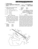 Medical device system including guide rod illumination diagram and image