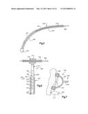 Medical device system including guide rod illumination diagram and image