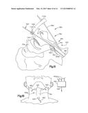 Medical device system including guide rod illumination diagram and image