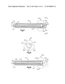 Medical device system including guide rod illumination diagram and image