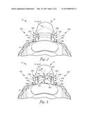 DEVICE AND SYSTEM TO REDUCE TRAUMATIC BRAIN INJURY diagram and image