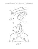 DEVICE AND SYSTEM TO REDUCE TRAUMATIC BRAIN INJURY diagram and image