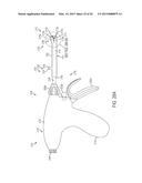 INTEGRATED SYSTEMS FOR ELECTROSURGICAL STEAM OR SMOKE CONTROL diagram and image