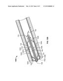 PLEATED OR FOLDED CATHETER-MOUNTED BALLOON diagram and image