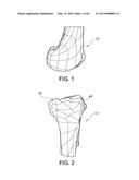 METHODS AND APPARATUS FOR PERFORMING KNEE ARTHROPLASTY diagram and image