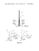 METHODS AND APPARATUS FOR PERFORMING KNEE ARTHROPLASTY diagram and image