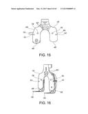 METHODS AND APPARATUS FOR PERFORMING KNEE ARTHROPLASTY diagram and image