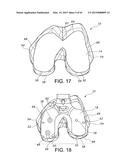 METHODS AND APPARATUS FOR PERFORMING KNEE ARTHROPLASTY diagram and image