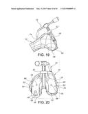 METHODS AND APPARATUS FOR PERFORMING KNEE ARTHROPLASTY diagram and image