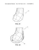 METHODS AND APPARATUS FOR PERFORMING KNEE ARTHROPLASTY diagram and image