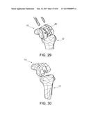 METHODS AND APPARATUS FOR PERFORMING KNEE ARTHROPLASTY diagram and image