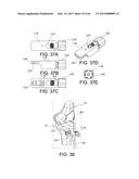 METHODS AND APPARATUS FOR PERFORMING KNEE ARTHROPLASTY diagram and image